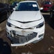 1G1ZD5ST4JF135649 2018 Chevrolet Malibu Lt auction photo thumbnail 6