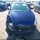 5NPDH4AE2DH400579 2013 Hyundai Elantra Gls auction photo thumbnail 6