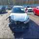 3N1AB7AP8GY310760 2016 Nissan Sentra Fe+ S auction photo thumbnail 13