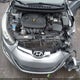 5NPDH4AE7FH562534 2015 Hyundai Elantra Limited auction photo thumbnail 10