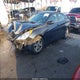 5NPEB4AC3BH159987 2011 Hyundai Sonata Gls auction photo thumbnail 2