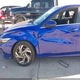 KMHLS4DG8SU920956 2025 Hyundai Elantra Sel Convenience auction photo thumbnail 6