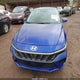KMHLS4DG7SU972322 2025 Hyundai Elantra Sel Convenience auction photo thumbnail 12