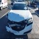 19UUB1F35FA016797 2015 Acura Tlx auction photo thumbnail 12