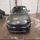 KMHLS4DG7SU009050 2025 Hyundai Elantra Sel Convenience auction photo thumbnail 13