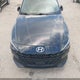 5NPLS4AG4MH031223 2021 Hyundai Elantra Sel auction photo thumbnail 12
