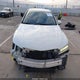 19UUB1F38HA008065 2017 Acura Tlx auction photo thumbnail 13