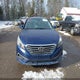 5NPE24AF3GH369622 2016 Hyundai Sonata Se auction photo thumbnail 13