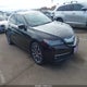 19UUB2F70FA011516 2015 Acura Tlx V6 Advance auction photo thumbnail 1