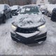 19UUB2F36JA011414 2018 Acura Tlx auction photo thumbnail 12