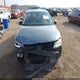 3VWDZ7AJ7BM320453 2011 Volkswagen Jetta 2.5L Se auction photo thumbnail 13