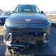 KM8HECA35RU167499 2024 Hyundai Kona Limited auction photo thumbnail 12