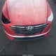 5NPEG4JA5NH143780 2022 Hyundai Sonata Se auction photo thumbnail 6