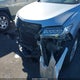 5J8TB4H51HL009560 2017 Acura Rdx Technology Acurawatch Plus Packages/W/Technology Package auction photo thumbnail 12