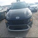 KM8K62AB9NU917873 2022 Hyundai Kona Sel auction photo thumbnail 12