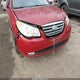 KMHDU4AD1AU043198 2010 Hyundai Elantra Gls auction photo thumbnail 6