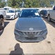 KMHLM4DG7RU676009 2024 Hyundai Elantra Sel auction photo thumbnail 12