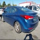 KMHDH4AEXFU223865 2015 Hyundai Elantra Se auction photo thumbnail 3