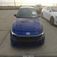 KMHLL4DG9RU687564 2024 Hyundai Elantra Se auction photo thumbnail 12