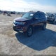 2HNYD2H59BH520645 2011 Acura Mdx Advance Package auction photo thumbnail 2