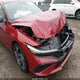 KMHLM4DG2SU022430 2025 Hyundai Elantra Sel Sport auction photo thumbnail 6