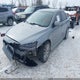 JA32V2FW8FU019493 2015 Mitsubishi Lancer Se auction photo thumbnail 2
