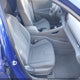 KMHLM4DG6RU779180 2024 Hyundai Elantra Sel auction photo thumbnail 5