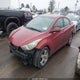 KMHDH4AE6BU138211 2011 Hyundai Elantra Gls (Ulsan Plant) auction photo thumbnail 2