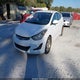 5NPDH4AE4FH567738 2015 Hyundai Elantra Se auction photo thumbnail 2