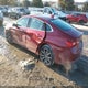 1G1ZD5ST3JF208221 2018 Chevrolet Malibu Lt auction photo thumbnail 3