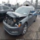 1VWAS7A31FC119213 2015 Volkswagen Passat 1.8T Limited Edition auction photo thumbnail 2
