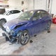KMHLM4DG4SU045630 2025 Hyundai Elantra Sel Sport auction photo thumbnail 2