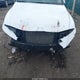 KMHLL4DG3SU943168 2025 Hyundai Elantra Se auction photo thumbnail 6