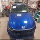 KMHLM4DGXTU098821 2026 Hyundai Elantra Sel Sport auction photo thumbnail 12