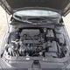 KMHLM4DG8SU953093 2025 Hyundai Elantra Sel Sport auction photo thumbnail 10