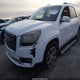 1GKKRRKD0GJ149813 2016 GMC Acadia Slt-1 auction photo thumbnail 6