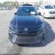 4T1DAACK5SU517576 2025 Toyota Camry Se auction photo thumbnail 12