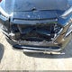KM8K1CAA0JU177748 2018 Hyundai Kona Se auction photo thumbnail 6