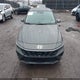 KMHLL4DGXSU865469 2025 Hyundai Elantra Se auction photo thumbnail 12