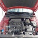 KMHLM4DG7SU904533 2025 Hyundai Elantra Sel Sport auction photo thumbnail 10