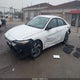 KMHLM4DGXSU994244 2025 Hyundai Elantra Sel Sport auction photo thumbnail 2