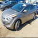 5NPDH4AE4GH668022 2016 Hyundai Elantra Value Edition auction photo thumbnail 2