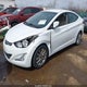 5NPDH4AE8GH684868 2016 Hyundai Elantra Se auction photo thumbnail 2