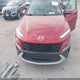 KM8K62ABXNU759656 2022 Hyundai Kona Sel auction photo thumbnail 6