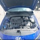 KMHLM4DG2SU978698 2025 Hyundai Elantra Sel Sport auction photo thumbnail 10