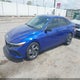 KMHLM4DG2SU978698 2025 Hyundai Elantra Sel Sport auction photo thumbnail 2