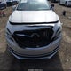1G4ZP5SZ7JU126406 2018 Buick Lacrosse Essence auction photo thumbnail 6