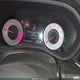 19UUB5F52NA004100 2022 Acura Tlx A-Spec Package auction photo thumbnail 7