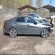 KMHLM4DG2SU962503 2025 Hyundai Elantra Sel Sport auction photo thumbnail 13