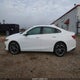 1G1ZD5ST8RF125430 2024 Chevrolet Malibu Fwd 1Lt auction photo thumbnail 14
